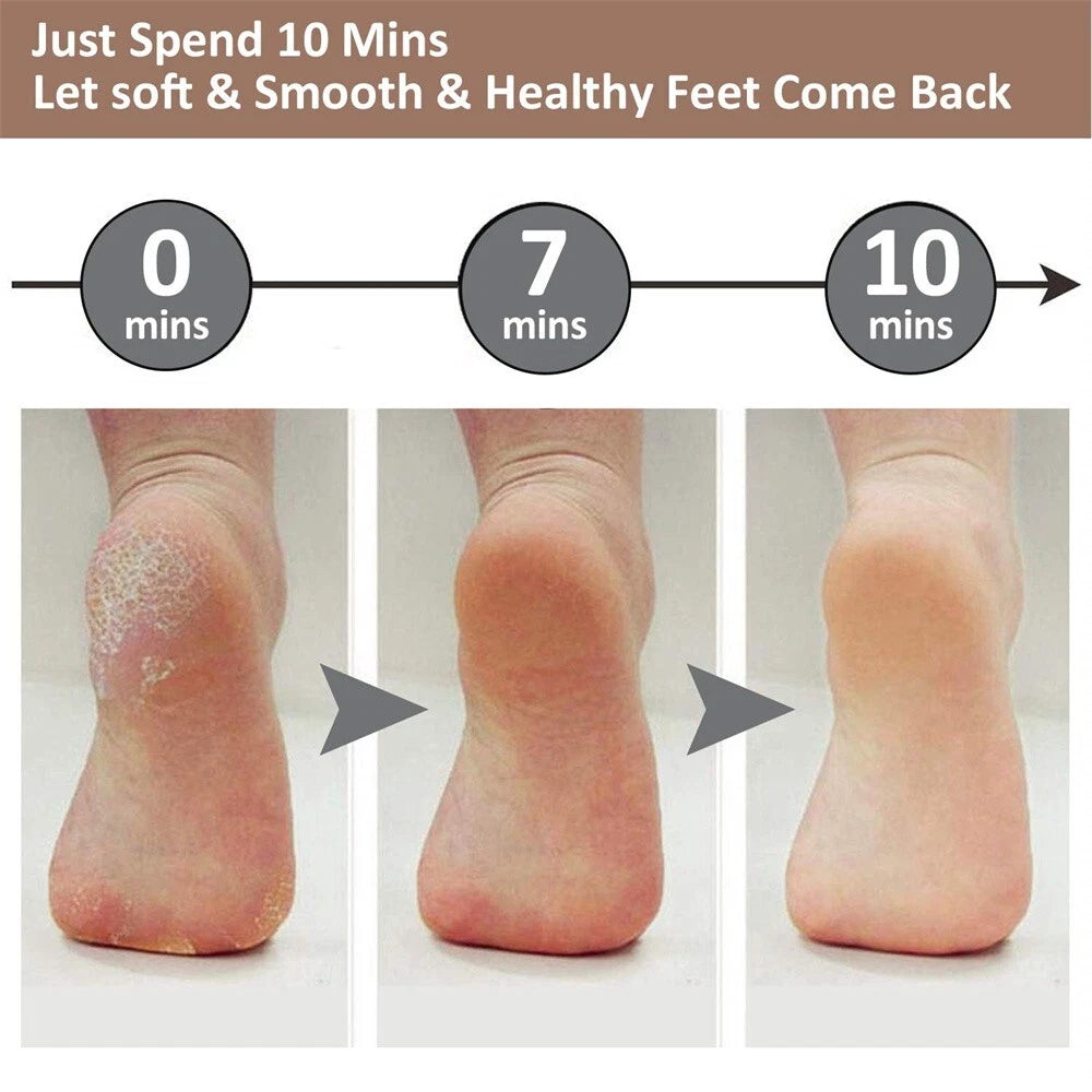 Electric Foot Callus Remover- Professional Foot Cleaner for Dead Skin