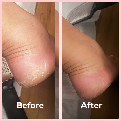 Silicon Foot Moisturizing Socks (Buy 1 Get 1 Free)