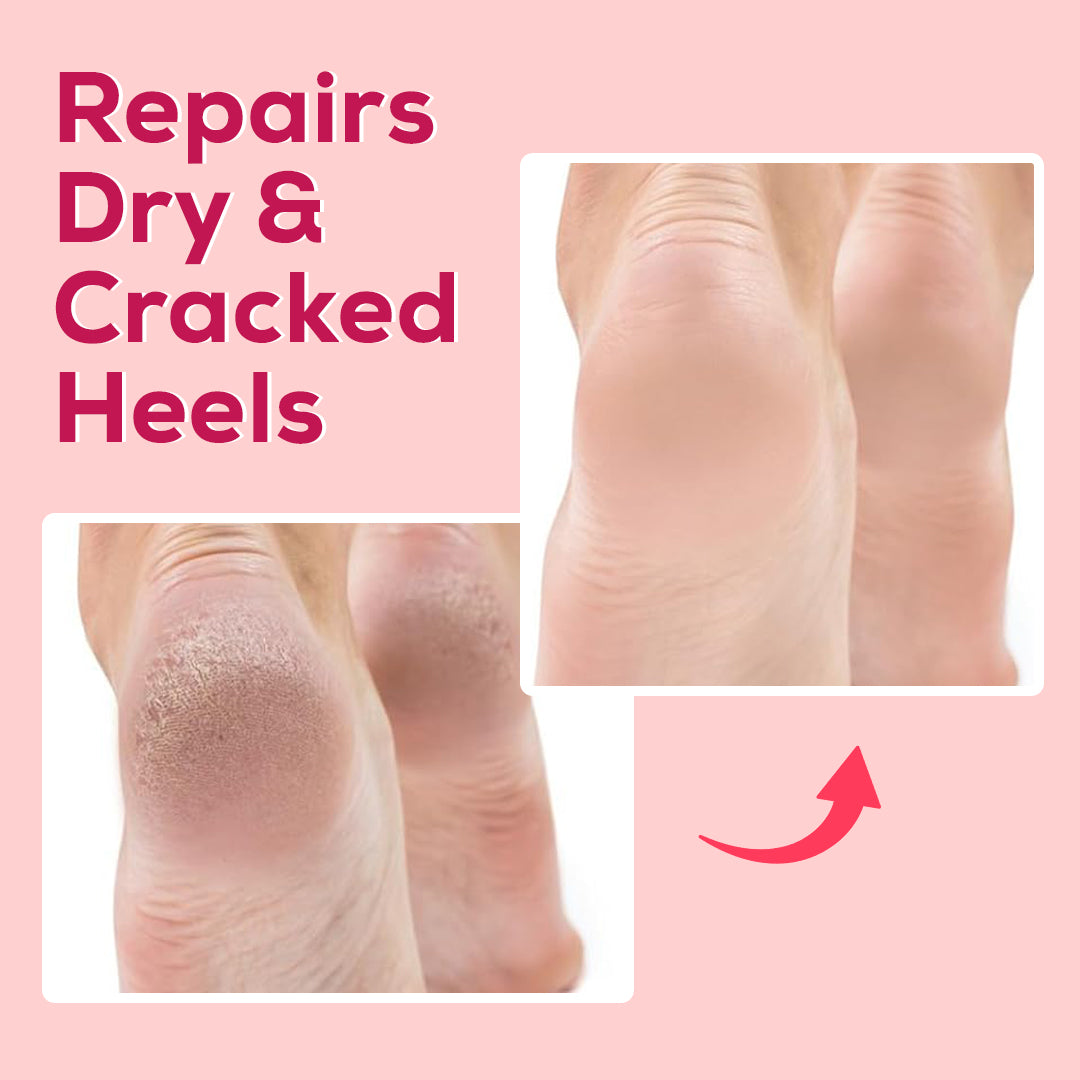 Silicon Foot Moisturizing Socks (Buy 1 Get 1 Free)
