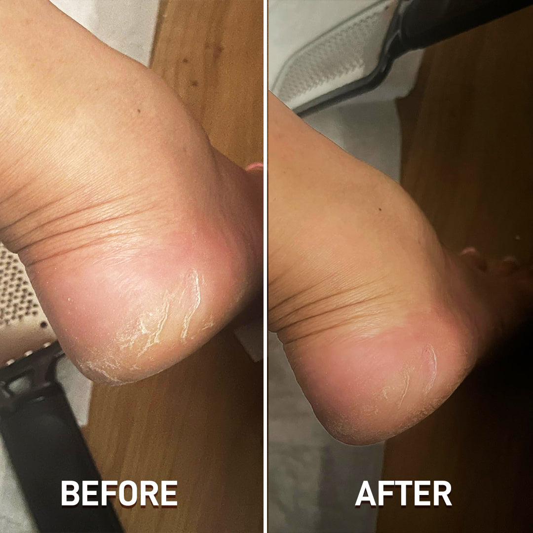 Foot File Scraper